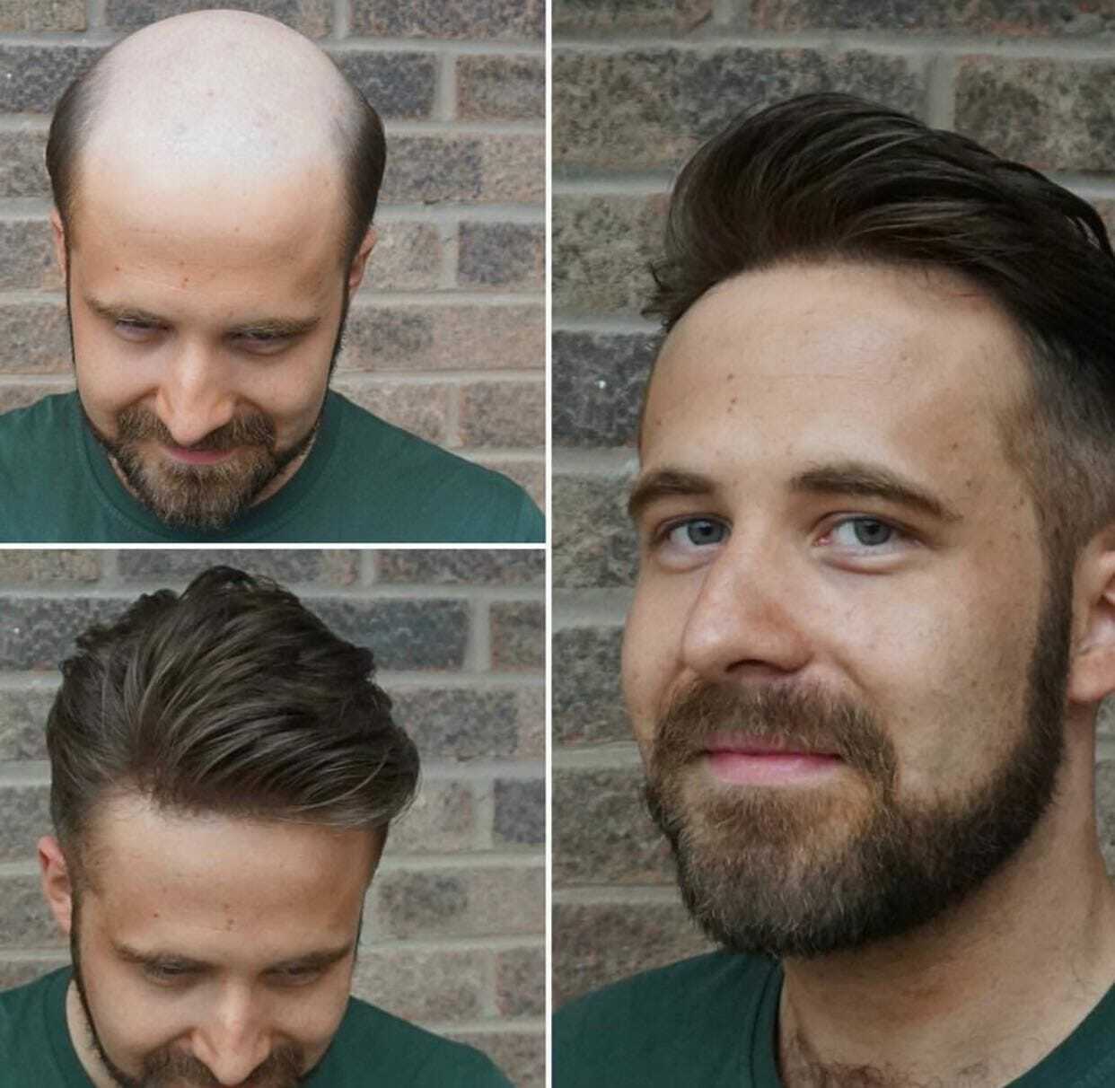 Guide til Forskellige Hårtyper